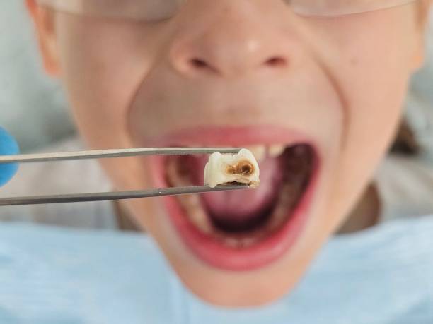 Best Broken Tooth Emergency  in Saint John Fisher College, NY